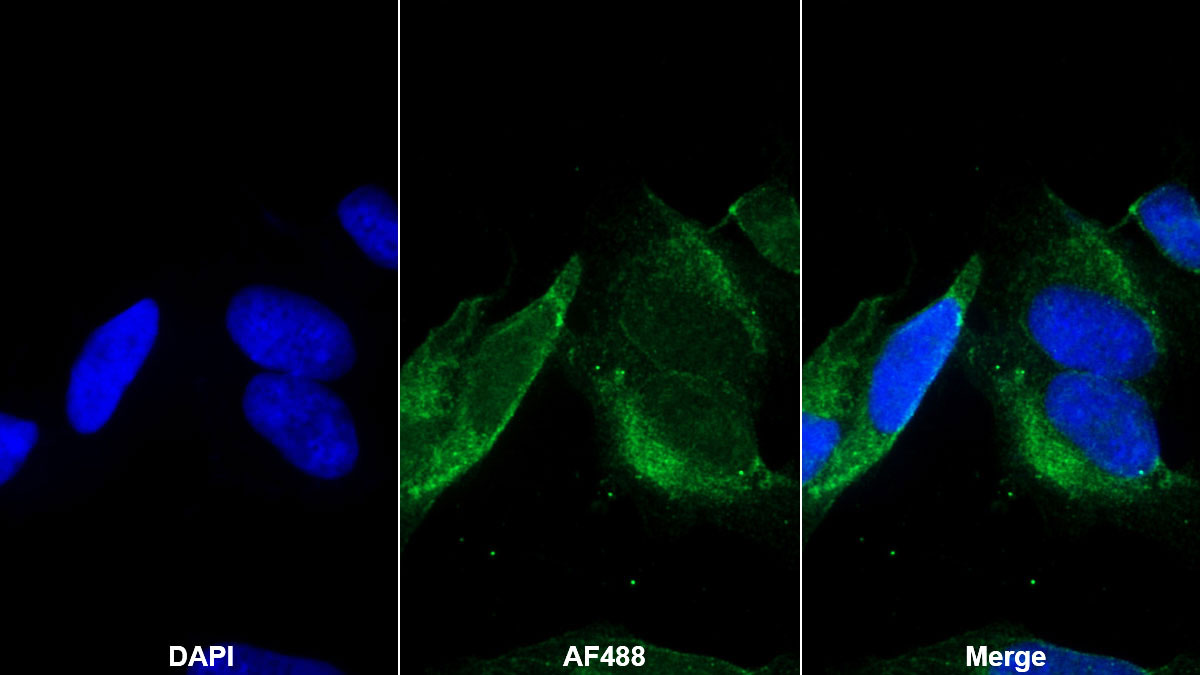 Polyclonal Antibody to Semaphorin 5B (SEMA5B)