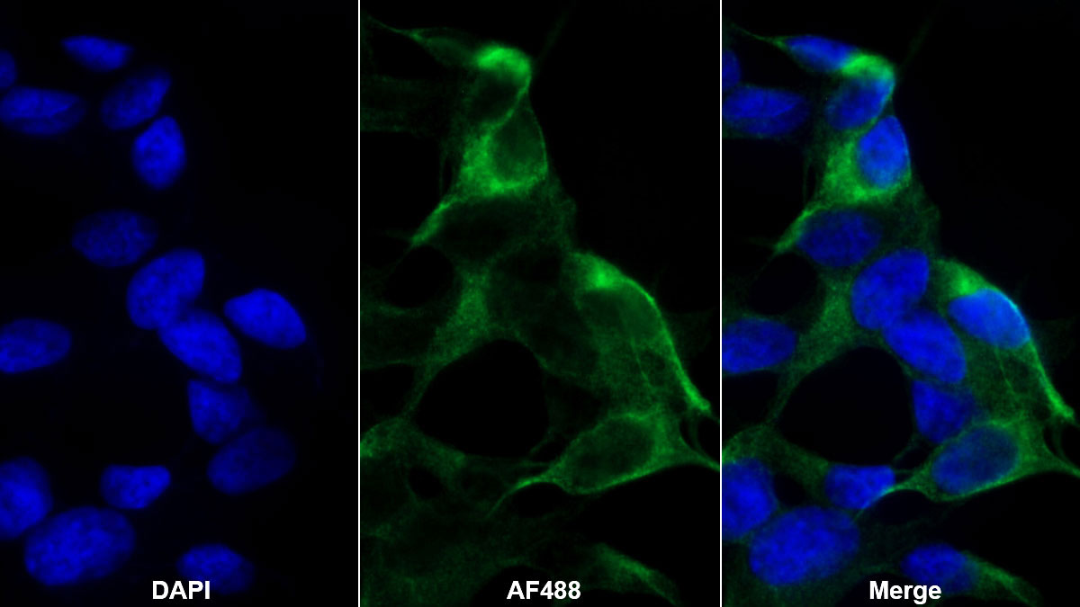 Polyclonal Antibody to Semaphorin 5B (SEMA5B)