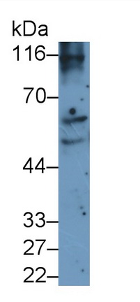 Polyclonal Antibody to Ribosomal Protein S6 Kinase Beta 2 (RPS6Kb2)