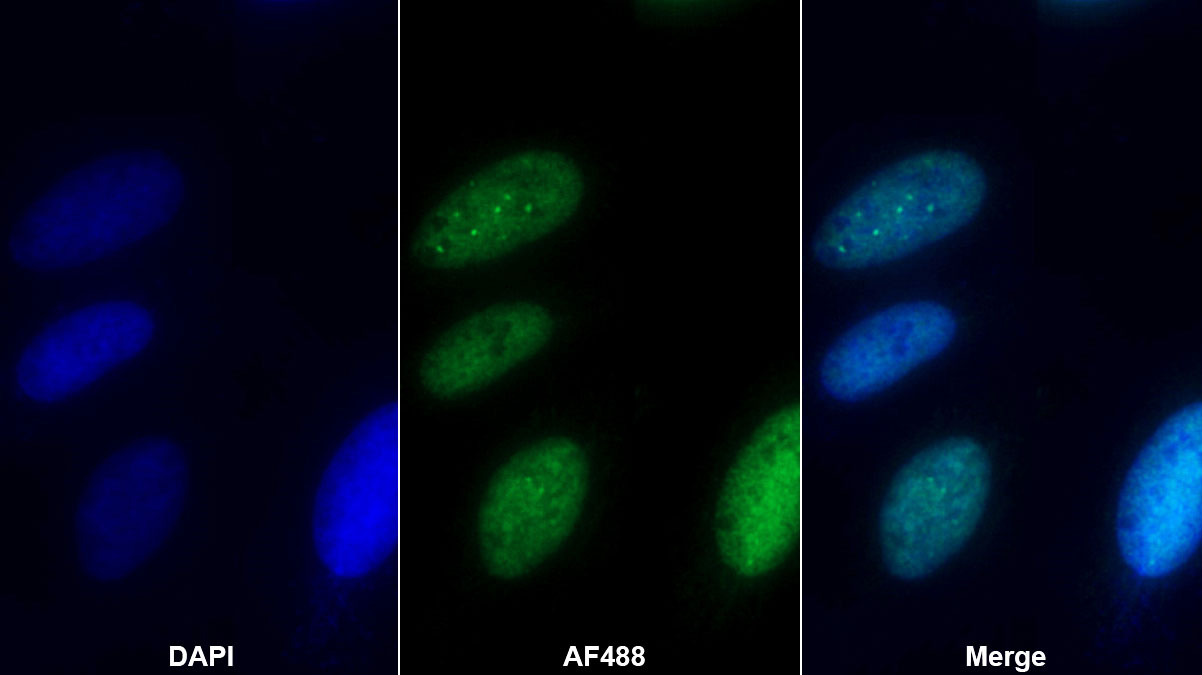 Polyclonal Antibody to REV1 Homolog (REV1)