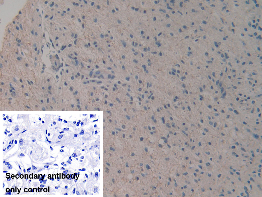 Polyclonal Antibody to R-Spondin 3 (RSPO3)