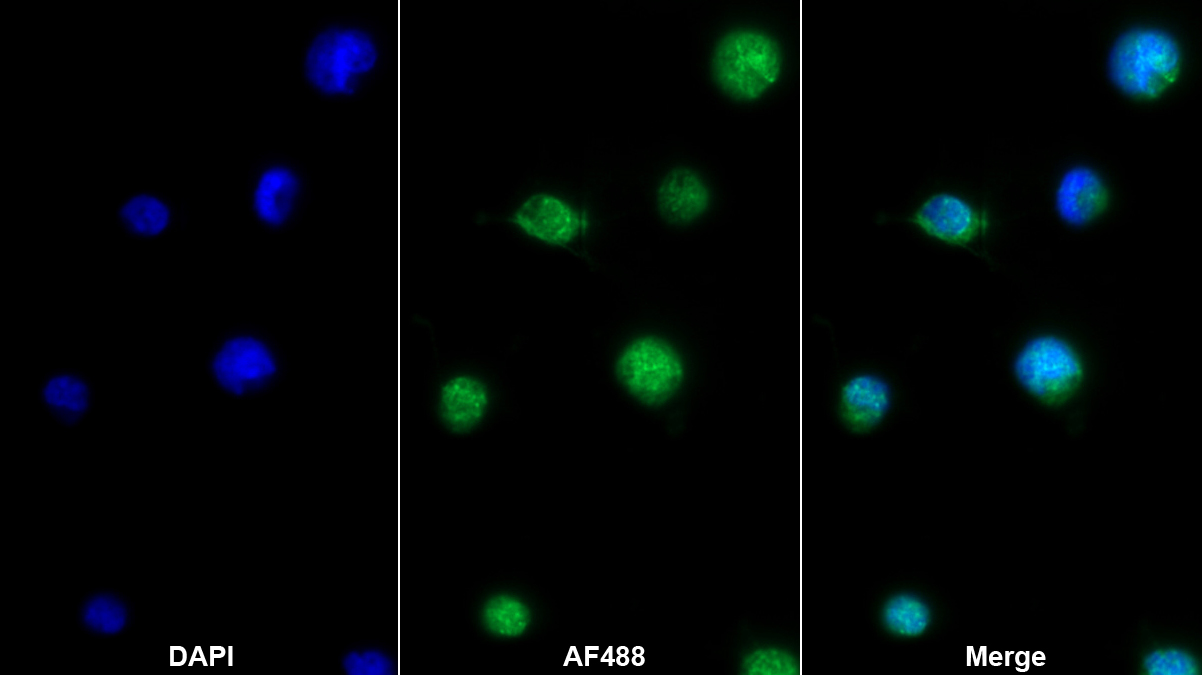 Polyclonal Antibody to CD27 Binding Protein (CD27BP)