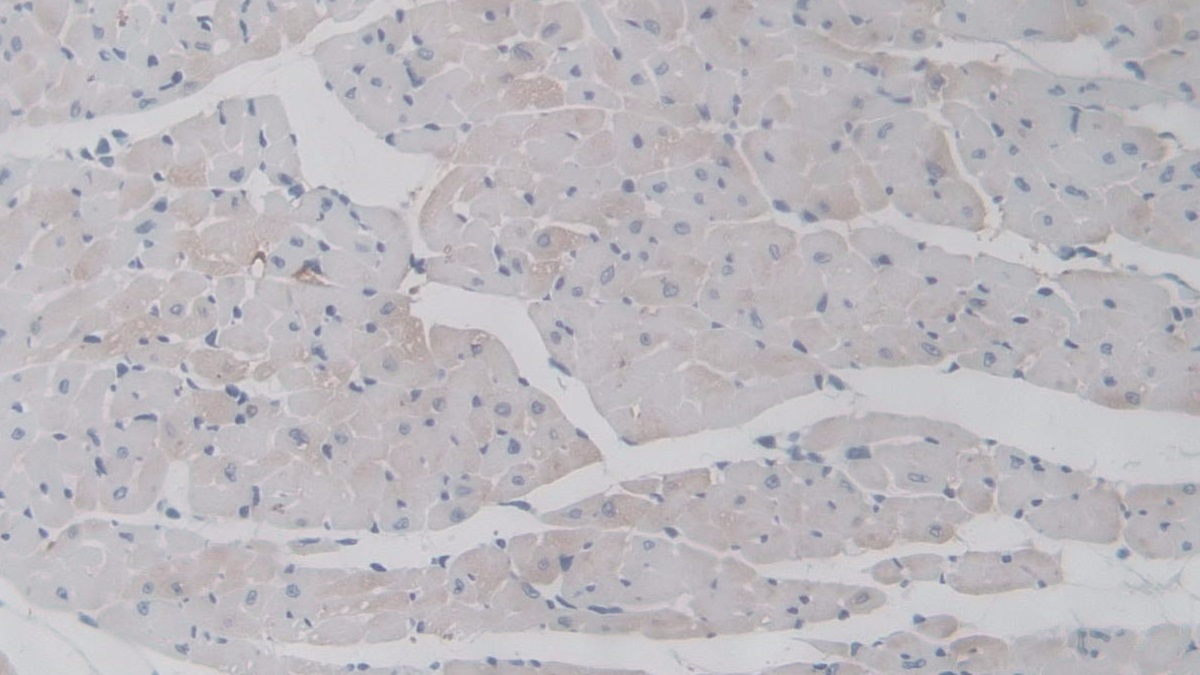 Polyclonal Antibody to Tumor Necrosis Factor Alpha Induced Protein 6 (TNFaIP6)