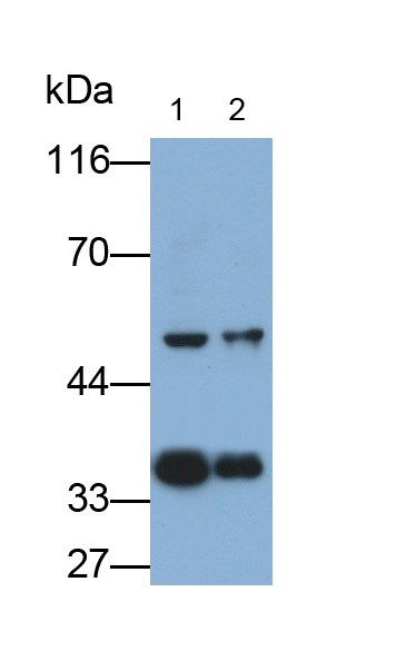 Polyclonal Antibody to Twinfilin 1 (TWF1)