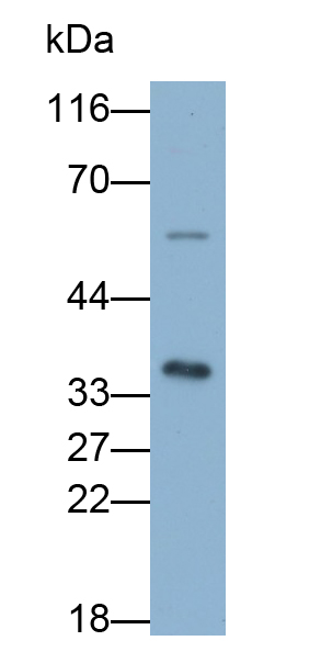 Polyclonal Antibody to Twinfilin 1 (TWF1)