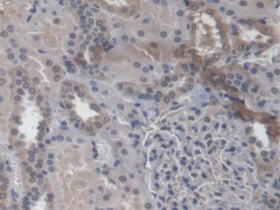 Polyclonal Antibody to RAB37, Member RAS Oncogene Family (RAB37)