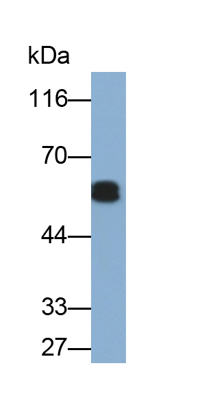 Polyclonal Antibody to Keratin 71 (KRT71)