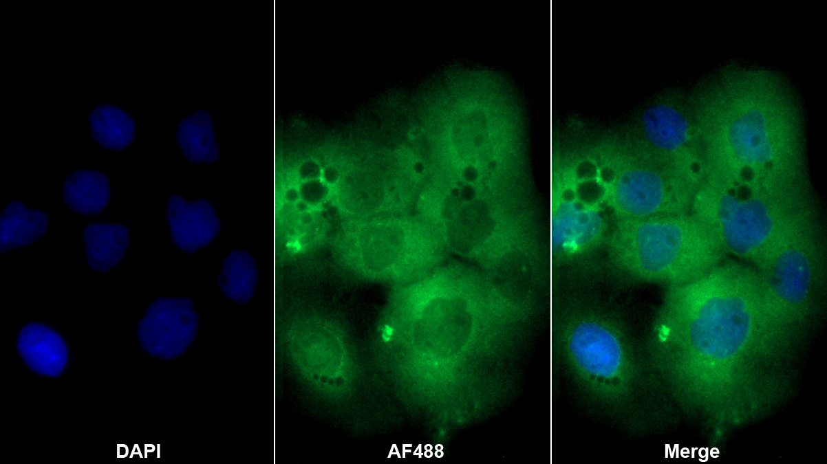 Polyclonal Antibody to BRCA1/BRCA2 Containing Complex Subunit 3 (BRCC3)