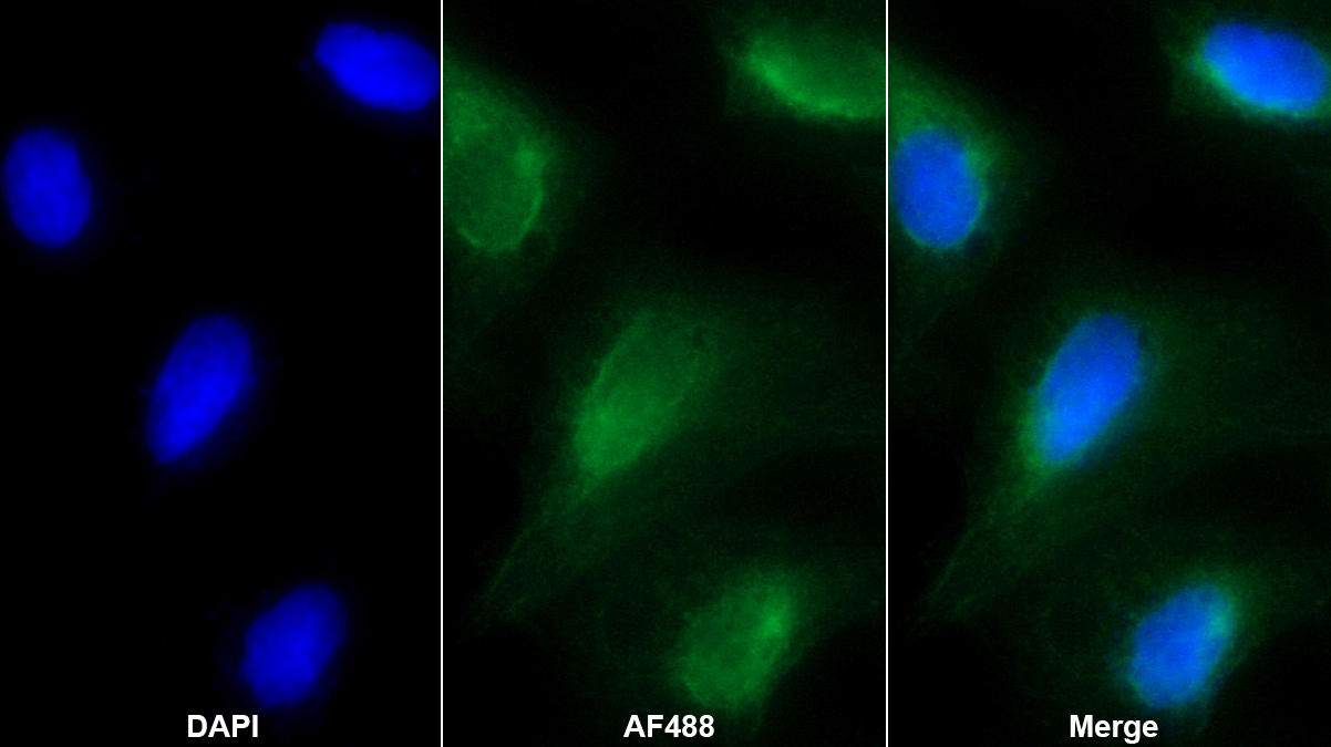 Polyclonal Antibody to Sp140 Nuclear Body Protein (SP140)