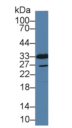 Polyclonal Antibody to Dickkopf Like Protein 1 (DKKL1)