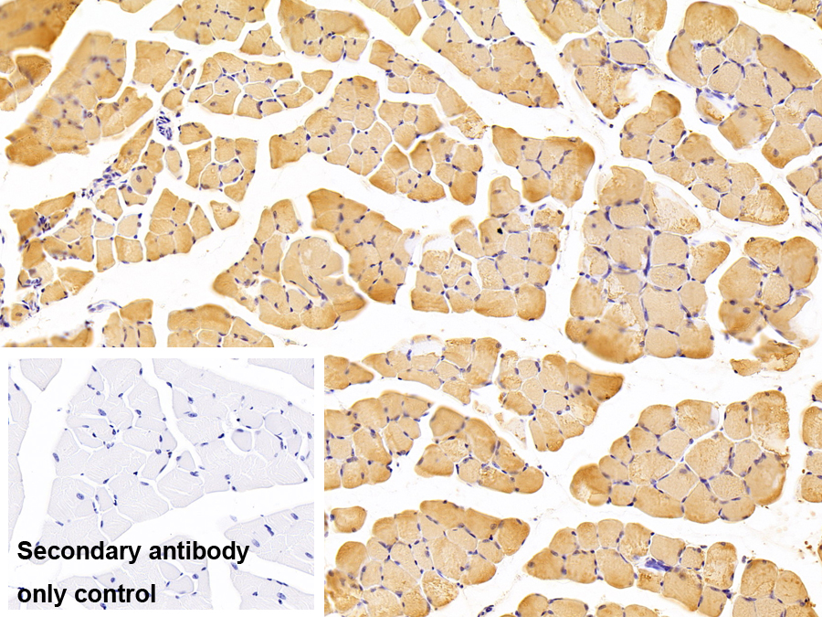 Polyclonal Antibody to Myosin Heavy Chain 7B, Cardiac Muscle Beta (MYH7B)