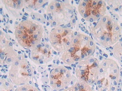 Polyclonal Antibody to Mucin 3B, Cell Surface Associated (MUC3B)