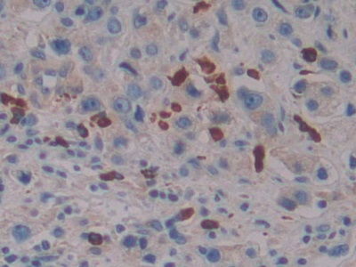 Polyclonal Antibody to Linker For Activation Of T-Cells Family, Member 2 (LAT2)