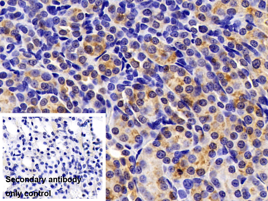 Polyclonal Antibody to Ribosomal Protein L23A (RPL23A)