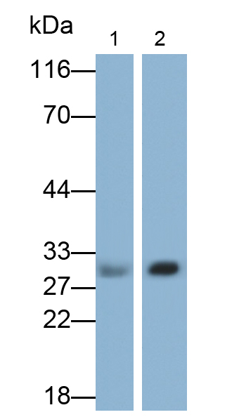 Polyclonal Antibody to RAB27B, Member RAS Oncogene Family (RAB27B)