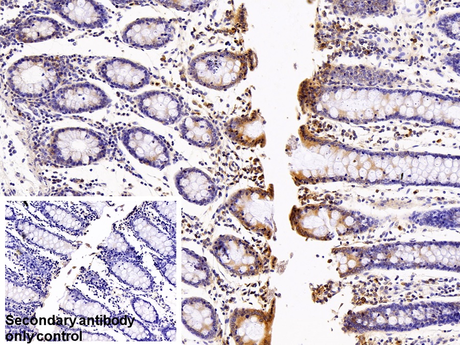 Polyclonal Antibody to Laminin Receptor 1 (LAMR1)