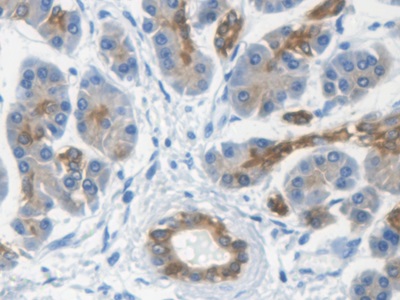 Polyclonal Antibody to Keratin 33A (KRT33A)