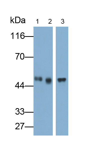 Polyclonal Antibody to Keratin 23 (KRT23)