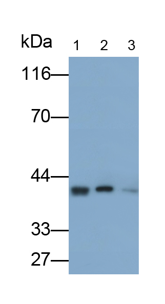 Polyclonal Antibody to Fc Fragment Of IgG Low Affinity IIb, Receptor (FcgR2B)