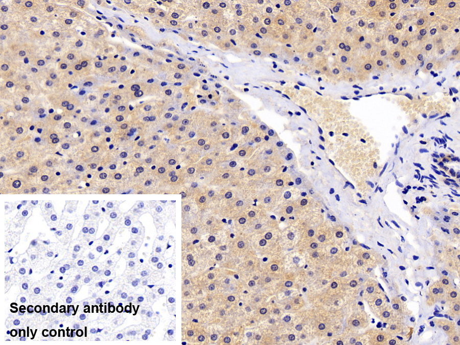 Polyclonal Antibody to Semaphorin 4B (SEMA4B)