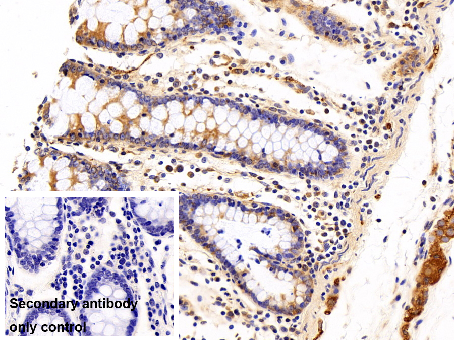 Polyclonal Antibody to Tubulin Alpha 1C (TUBa1C)