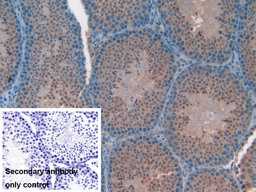 Polyclonal Antibody to Family With Sequence Similarity 19, Member A2 (FAM19A2)