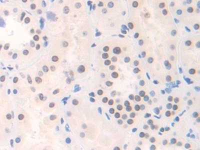 Polyclonal Antibody to Family With Sequence Similarity 19, Member A3 (FAM19A3)