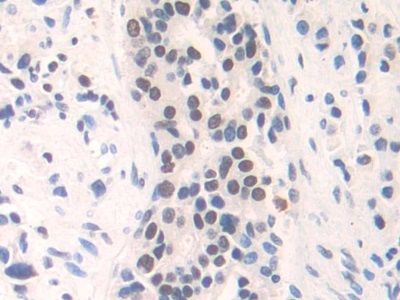 Polyclonal Antibody to Family With Sequence Similarity 19, Member A3 (FAM19A3)