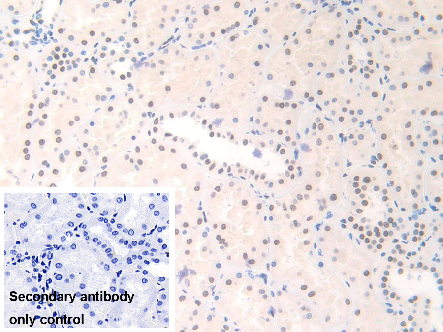 Polyclonal Antibody to Family With Sequence Similarity 19, Member A3 (FAM19A3)