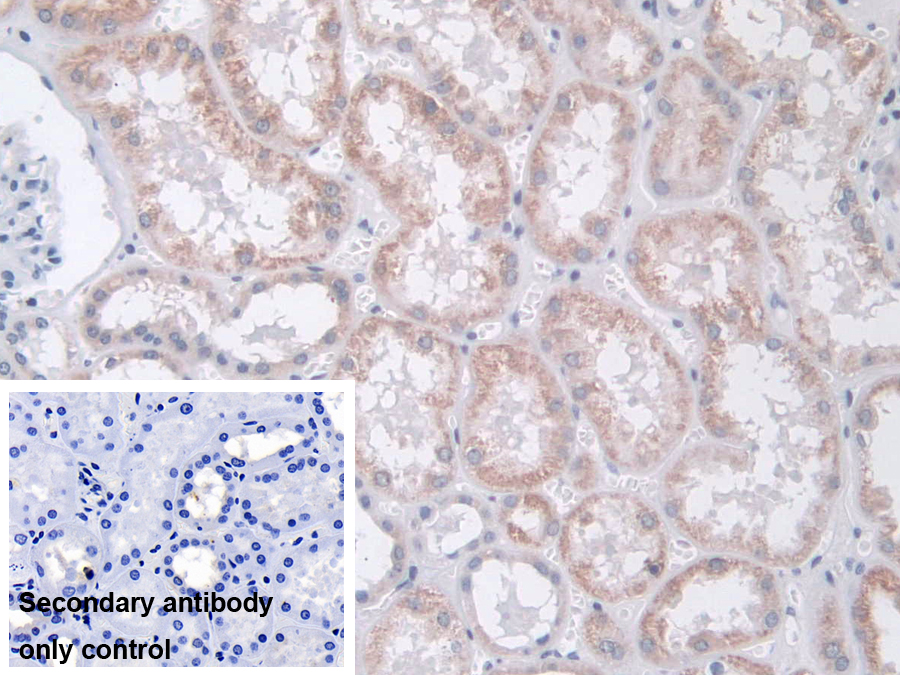 Polyclonal Antibody to MOCO Sulphurase C-Terminal Domain Containing Protein 1 (MOSC1)