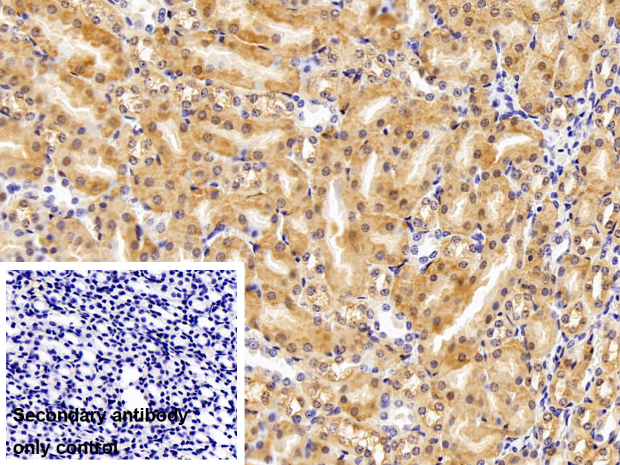 Polyclonal Antibody to MOCO Sulphurase C-Terminal Domain Containing Protein 1 (MOSC1)