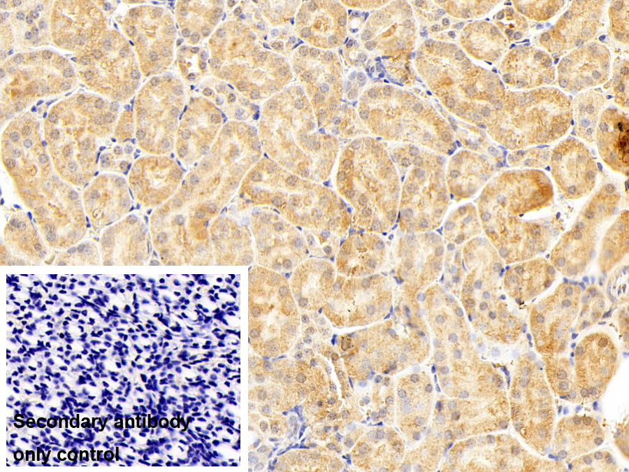 Polyclonal Antibody to Mixed Lineage Kinase Domain Like Protein (MLKL)