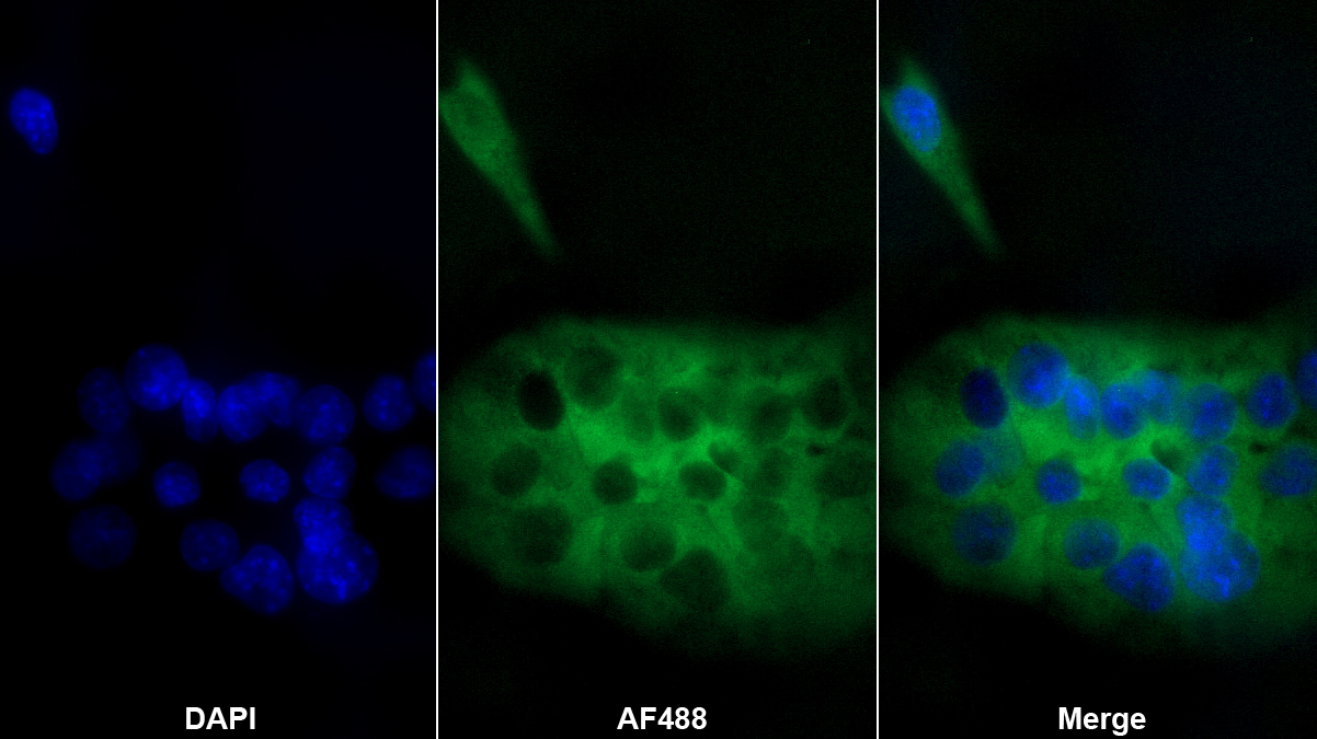 Polyclonal Antibody to LIM And Calponin Homology Domains Containing Protein 1 (LIMCH1)