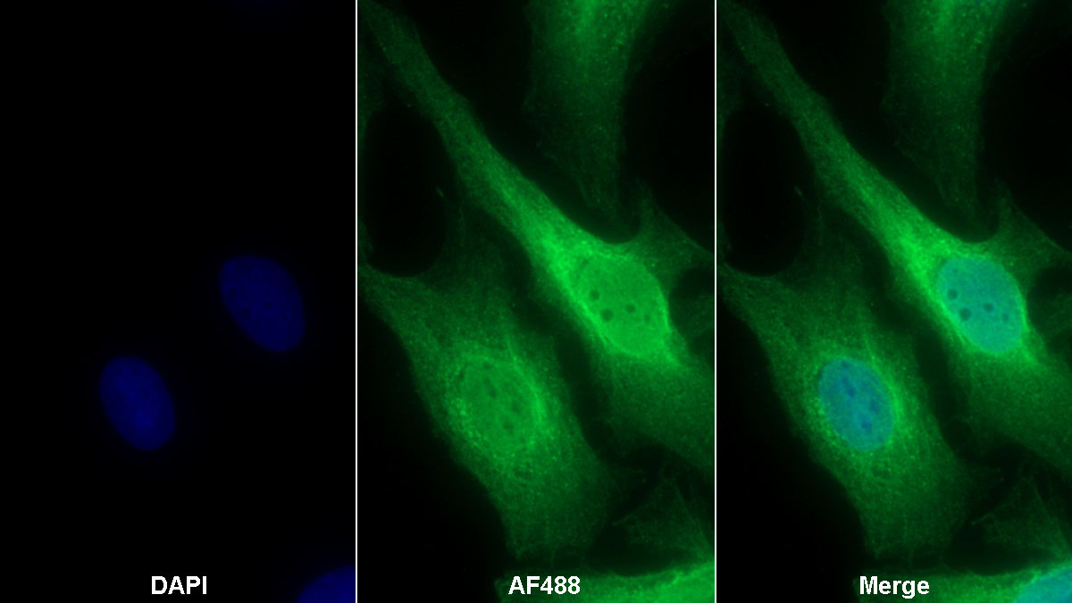 Polyclonal Antibody to Zymogen Granule Protein 16 Homolog B (ZG16B)