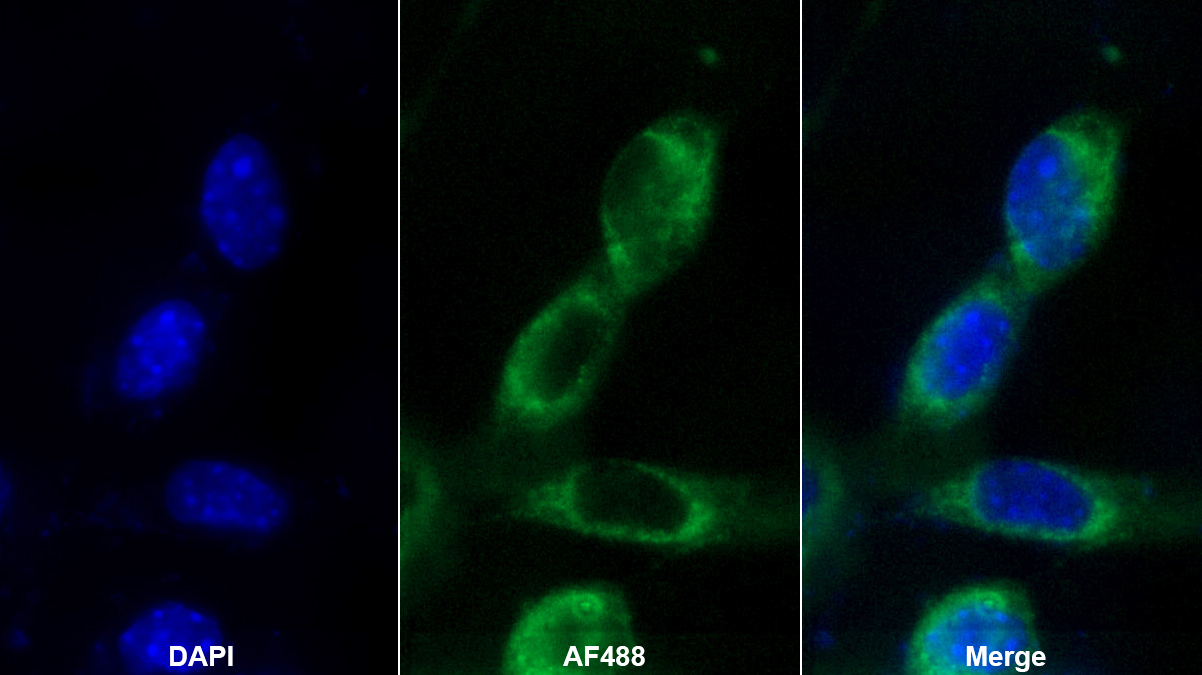 Polyclonal Antibody to Keratin 28 (KRT28)