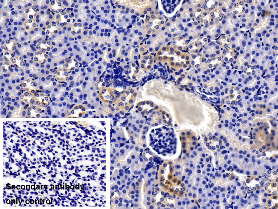 Polyclonal Antibody to Notch2 N-Terminal Like Protein (NOTCH2NL)