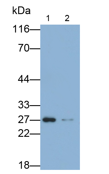Polyclonal Antibody to Ubiquitin Carboxyl Terminal Hydrolase L4 (UCHL4)