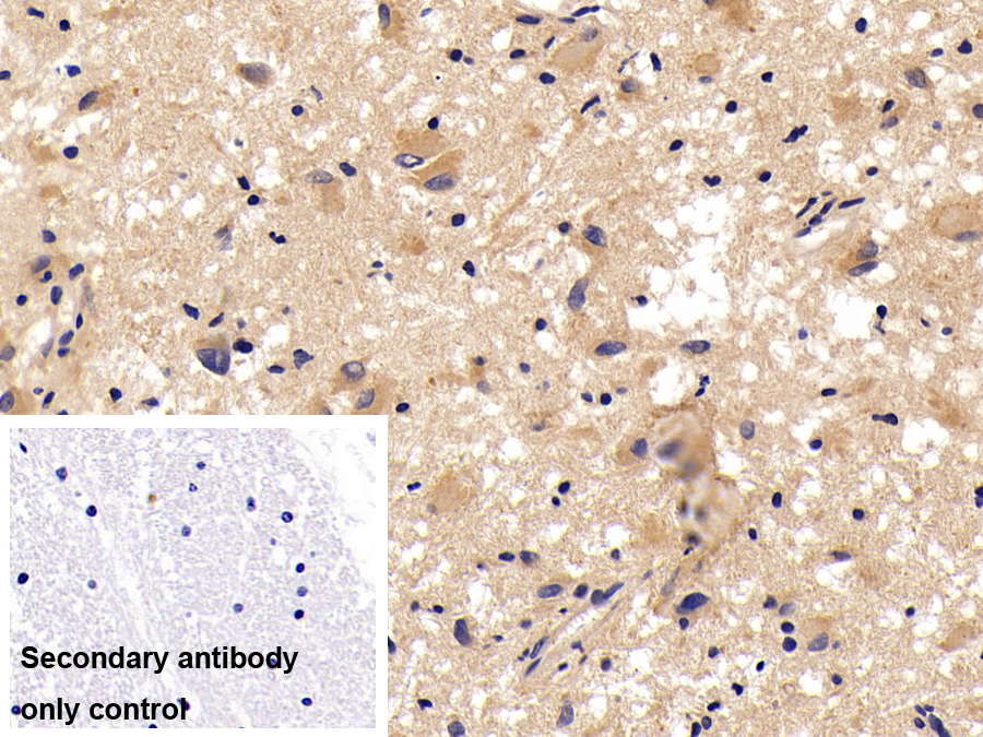 Polyclonal Antibody to Galectin 9C (GAL9C)