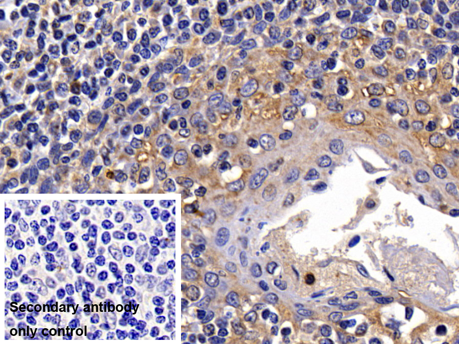 Polyclonal Antibody to Galectin 9C (GAL9C)