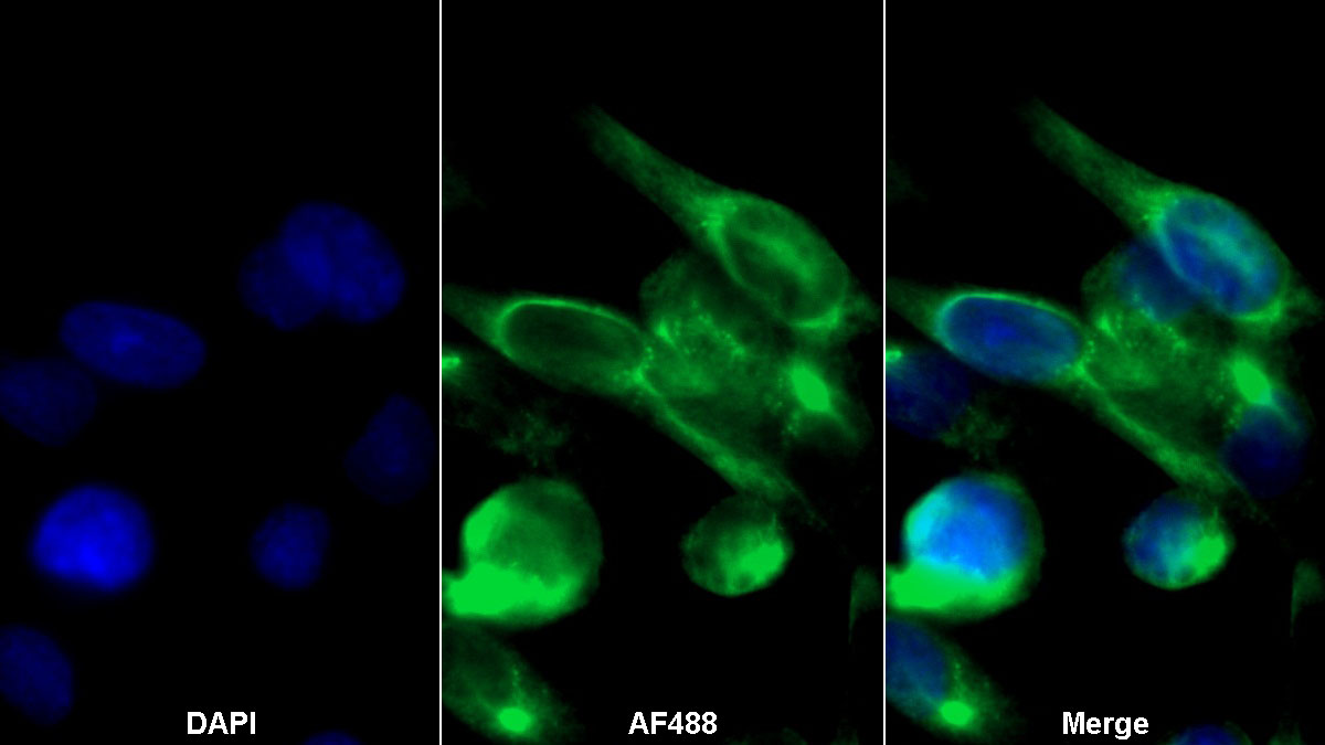 Recombinant Antibody to Programmed Cell Death Protein 1 Ligand 1 (PDL1)