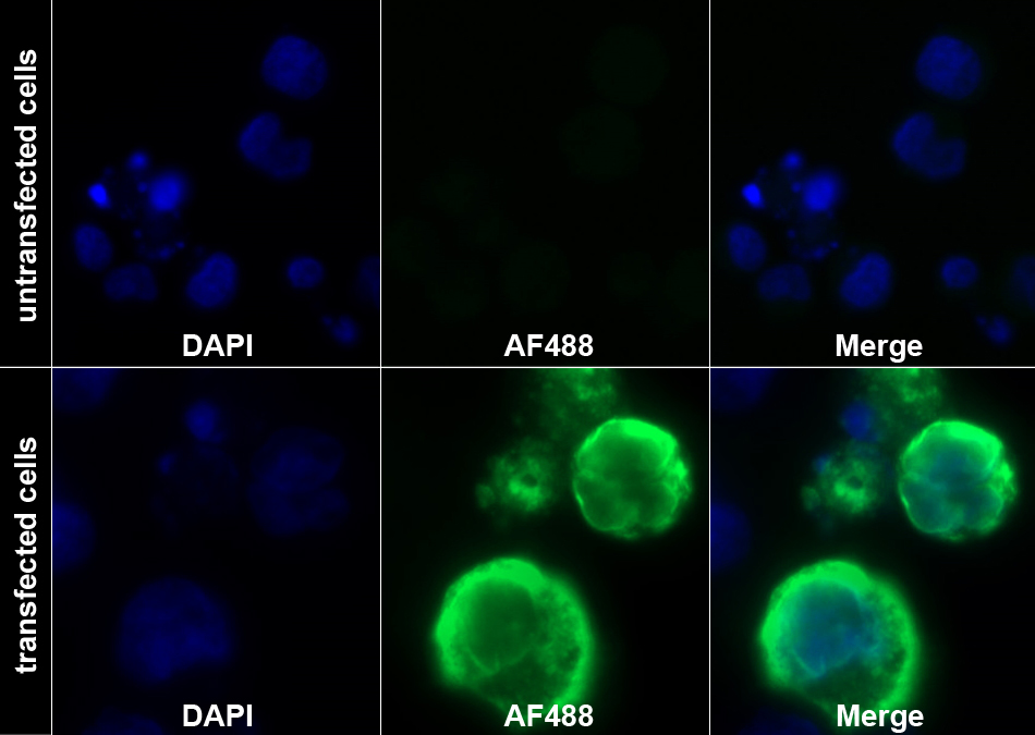 Recombinant Antibody to Cluster of Differentiation 79B (CD79B)