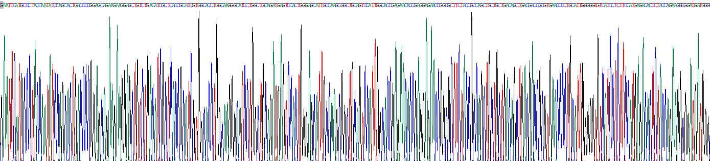 Recombinant Aldolase A, Fructose Bisphosphate (ALDOA)