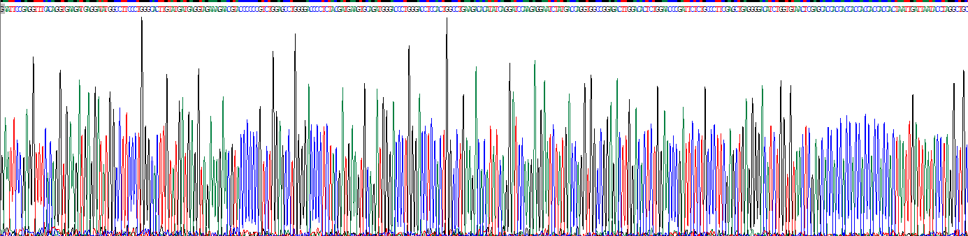 Recombinant Nephrin (NPHN)