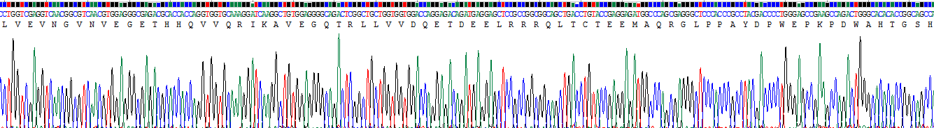 Recombinant Sodium Hydrogen Exchange Regulatory Cofactor 2 (SLC9A3R2)