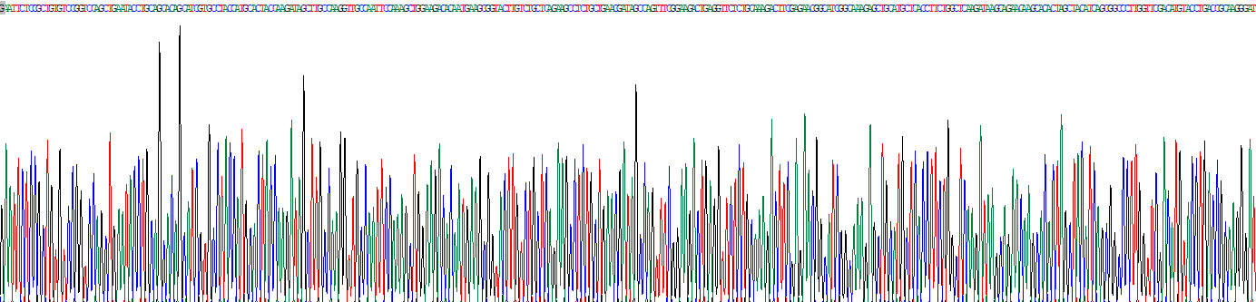 Recombinant Carnitine Palmitoyltransferase 2, Mitochondrial (CPT2)