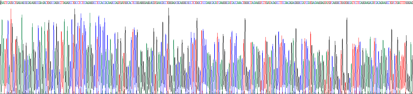 Recombinant Aminoadipate Semialdehyde Synthase (AASS)