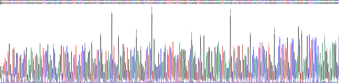 Recombinant Phosphofructokinase, Liver (PFKL)