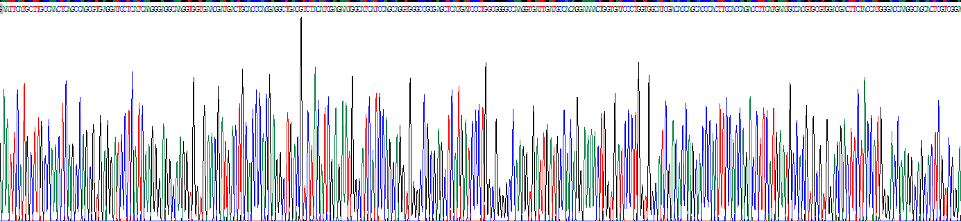 Recombinant Collapsin Response Mediator Protein 5 (CRMP5)