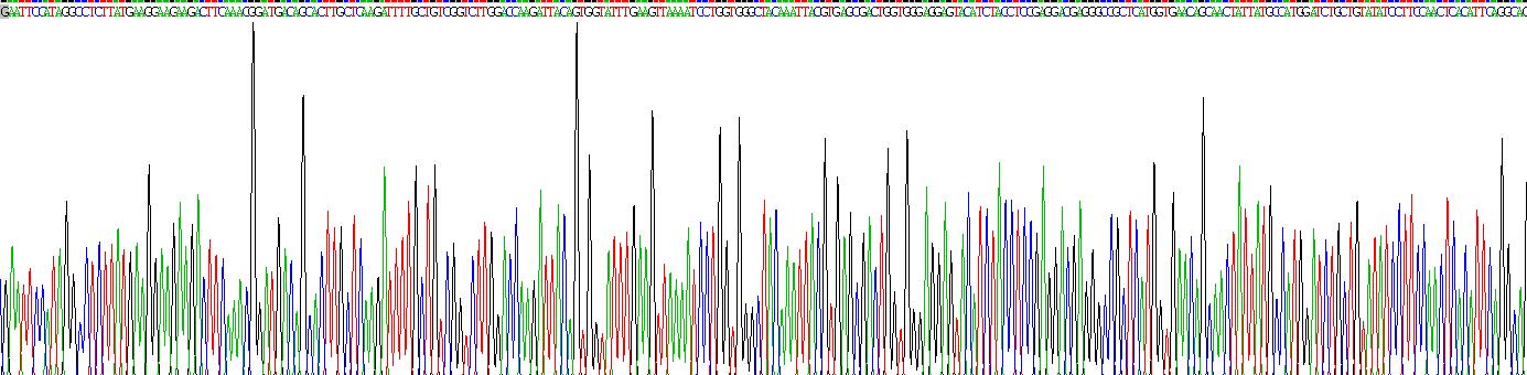 Recombinant Carnitine Palmitoyltransferase 1A, Liver (CPT1A)