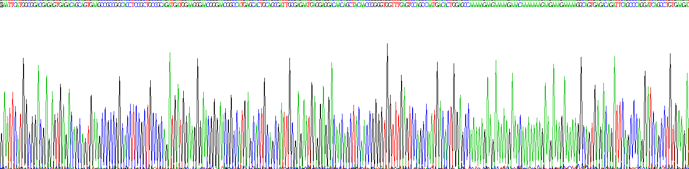 Recombinant N-Myristoyltransferase 1 (NMT1)